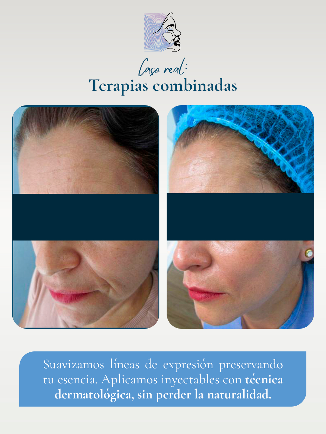 Antes-y-despues-3-1